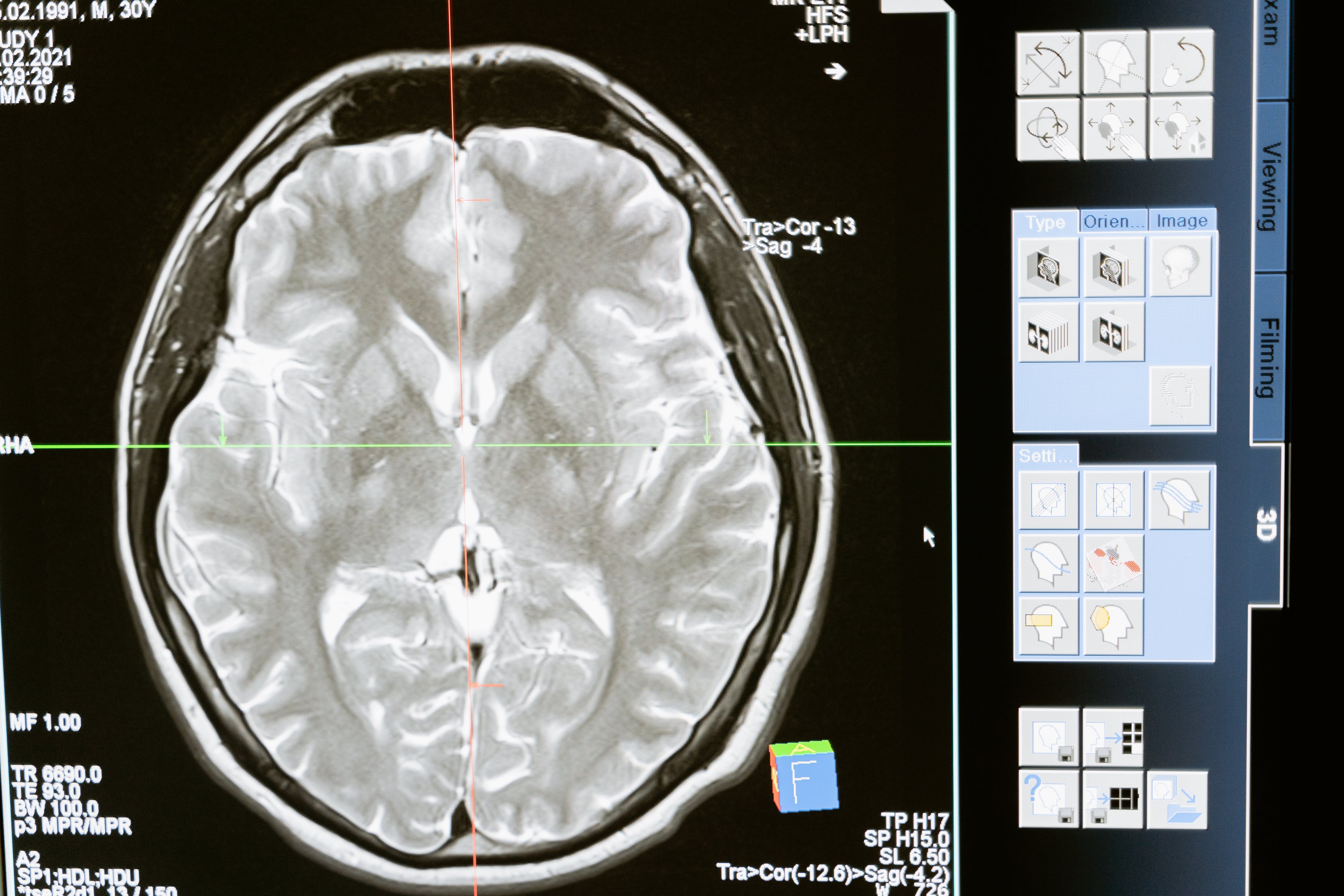 Deep Brain Stimulation as Treatment for Addiction in Humans